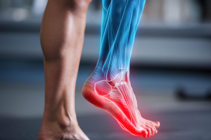 Ankle Ligament Sprains/Injuries